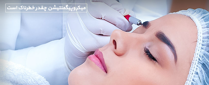 میکروپیگمنتیشن چقدر خطرناک است