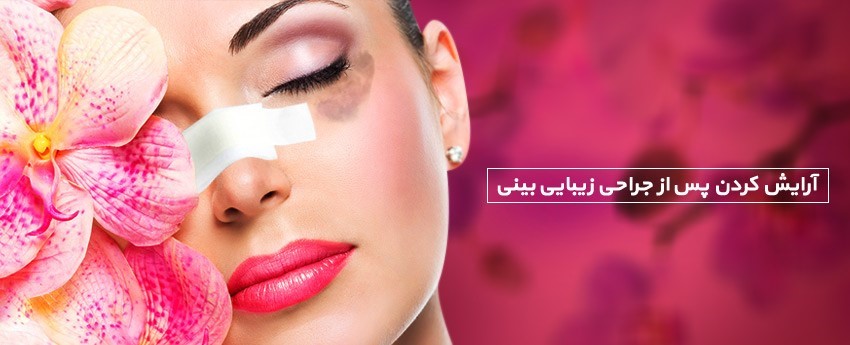 آرایش کردن پس از جراحی زیبایی بینی