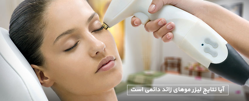 آیا نتایج لیزر موهای زائد دائمی است