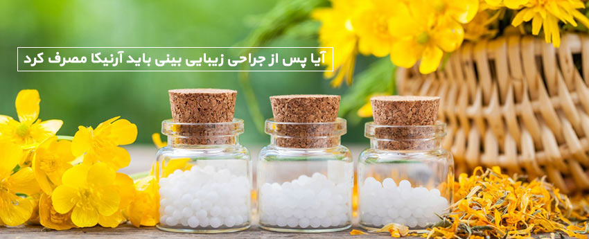 آیا پس از جراحی زیبایی بینی باید آرنیکا مصرف کرد