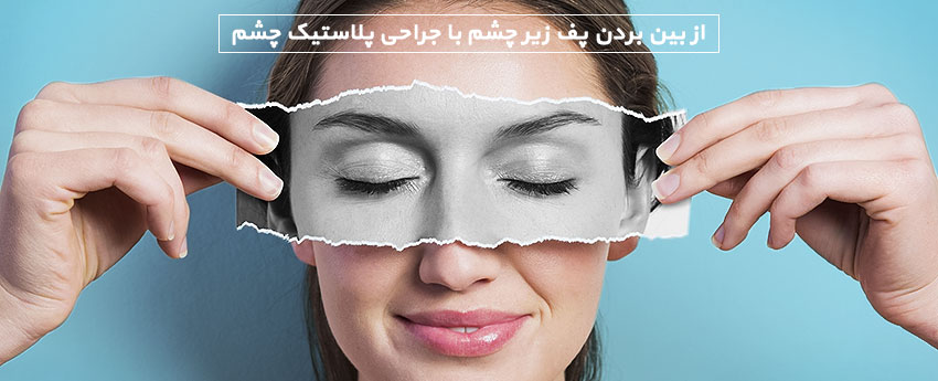 از بین بردن پف زیر چشم با جراحی پلاستیک چشم