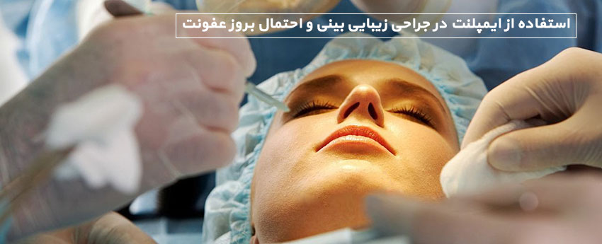 استفاده از ایمپلنت در جراحی زیبایی بینی و احتمال بروز عفونت