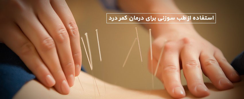 استفاده از طب سوزنی برای درمان کمر درد