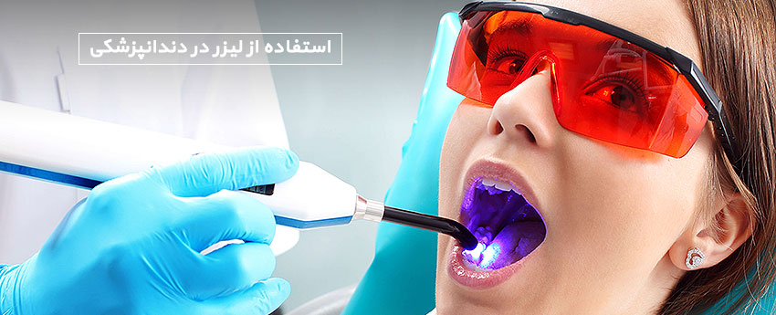 استفاده از لیزر در دندانپزشکی