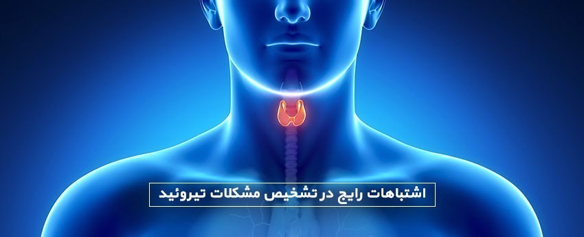 اشتباهات رایج در تشخیص مشکلات تیروئید