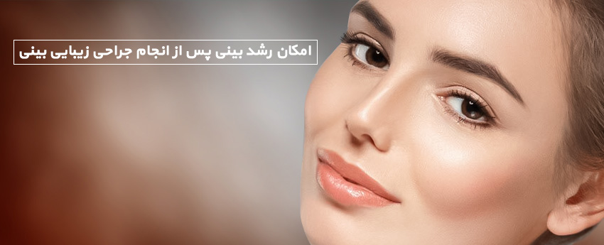 امکان رشد بینی پس از انجام جراحی زیبایی بینی