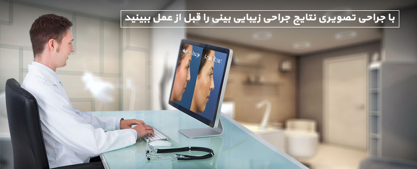 با جراحی تصویری نتایج جراحی زیبایی بینی را قبل از عمل ببینید
