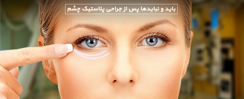 باید و نبایدها پس از جراحی پلاستیک چشم