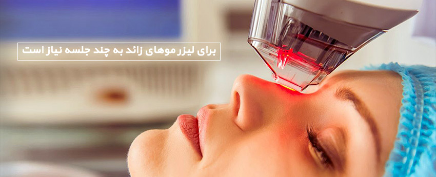 برای لیزر موهای زائد به چند جلسه نیاز است