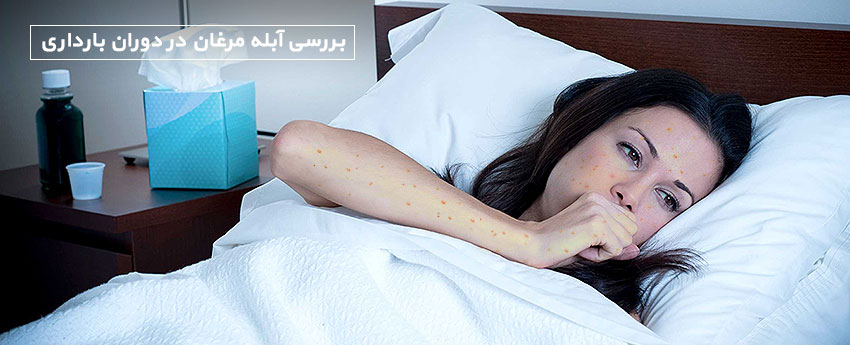 بررسی آبله مرغان در دوران بارداری