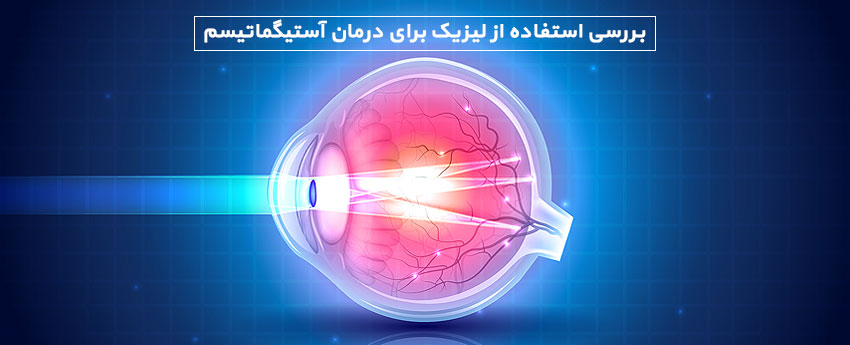 بررسی استفاده از لیزیک برای درمان آستیگماتیسم