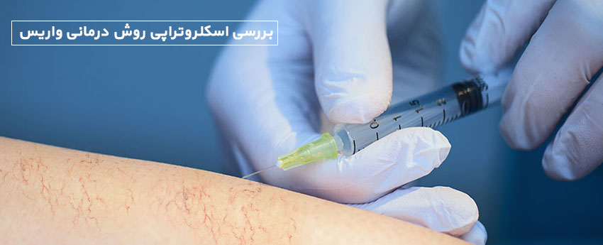 بررسی اسکلروتراپی روش درمانی واریس