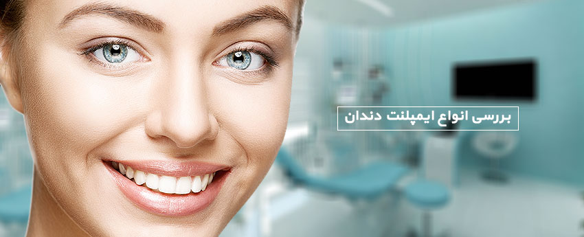 بررسی انواع ایمپلنت دندان