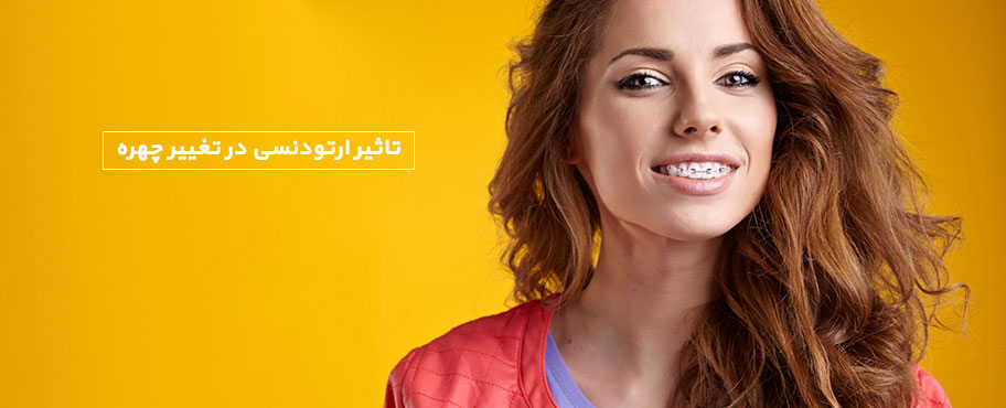 تاثیر ارتودنسی در تغییر چهره