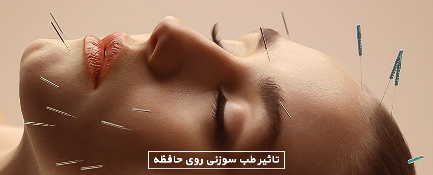 تاثیر طب سوزنی روی حافظه