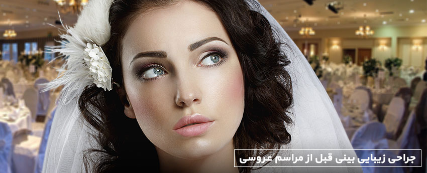 جراحی زیبایی بینی قبل از مراسم عروسی