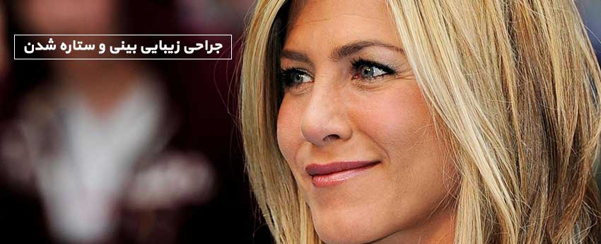 جراحی زیبایی بینی و ستاره شدن