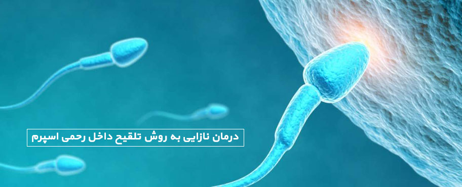 درمان نازایی به روش تلقیح داخل رحمی اسپرم