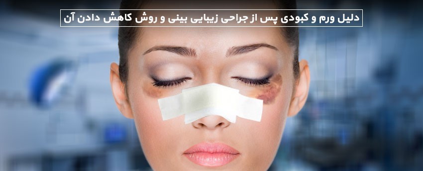 دلیل ورم و کبودی پس از جراحی زیبایی بینی و روش کاهش دادن آن