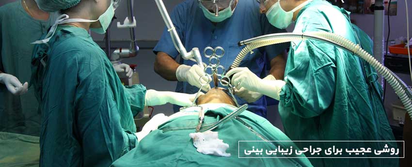 روشی عجیب برای جراحی زیبایی بینی