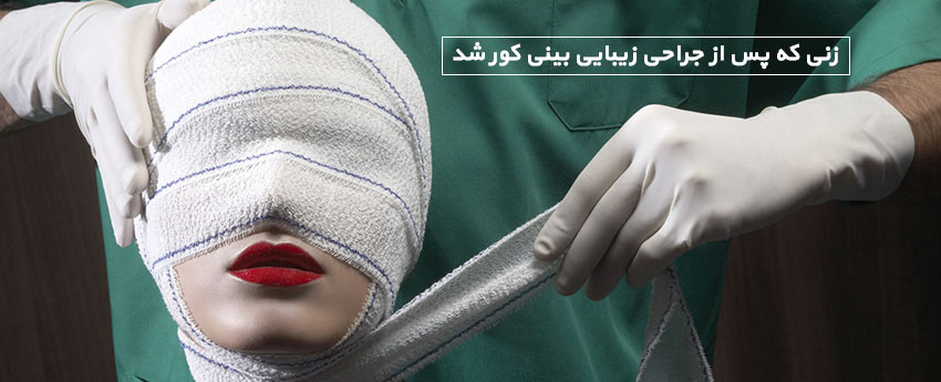 زنی که پس از جراحی زیبایی بینی کور شد