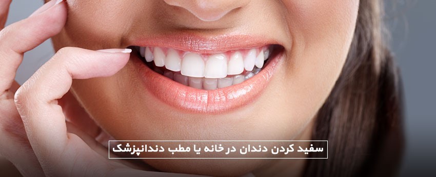 سفید کردن دندان در خانه یا مطب دندانپزشک