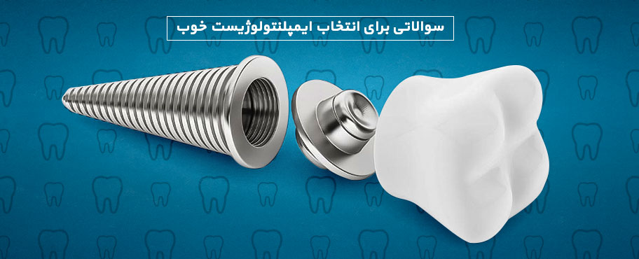 سوالاتی برای انتخاب ایمپلنتولوژیست خوب