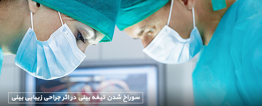 سوراخ شدن تیغه بینی در اثر جراحی زیبایی بینی