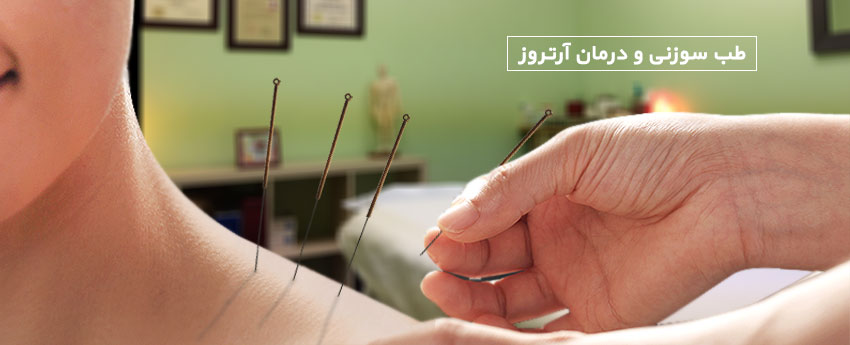 طب سوزنی و درمان آرتروز
