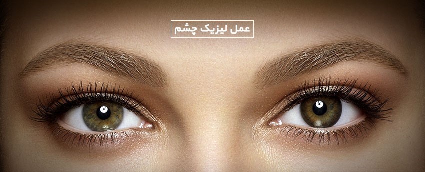 عمل لیزیک چشم