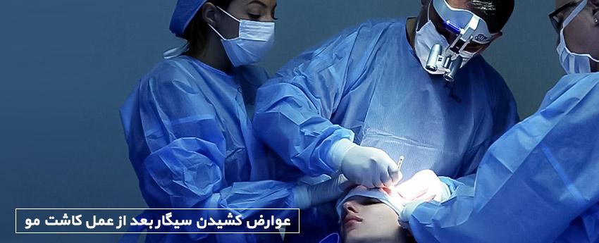 عوارض کشیدن سیگار بعد از عمل کاشت مو