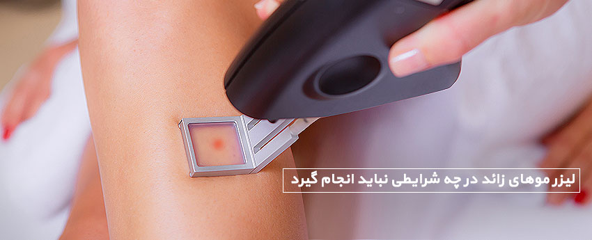 لیزر موهای زائد در چه شرایطی نباید انجام گیرد