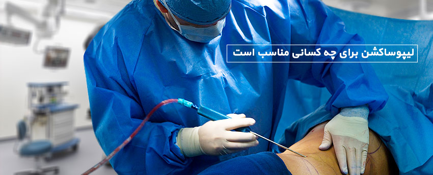لیپوساکشن برای چه کسانی مناسب است