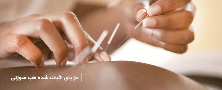 مزایای اثبات شده طب سوزنی