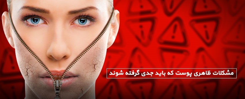 مشکلات ظاهری پوست که باید جدی گرفته شوند
