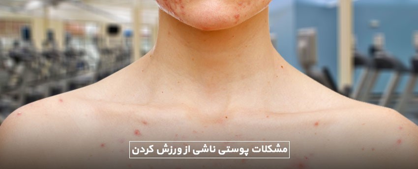 مشکلات پوستی ناشی از ورزش کردن