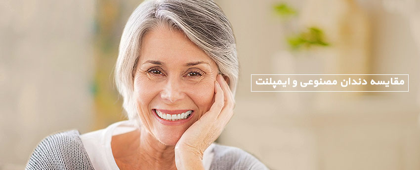 مقایسه دندان مصنوعی و ایمپلنت
