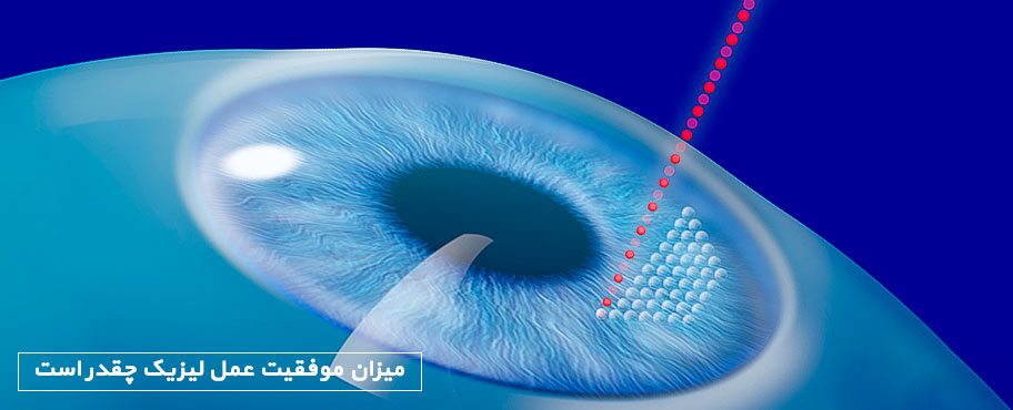 میزان موفقیت عمل لیزیک چقدر است