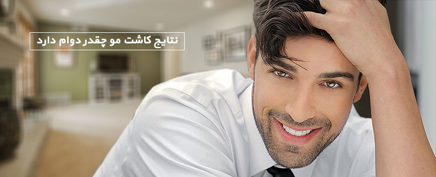 نتایج کاشت مو چقدر دوام دارد