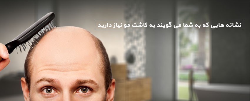 نشانه هایی که به شما می گویند به کاشت مو نیاز دارید
