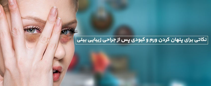 نکاتی برای پنهان کردن ورم و کبودی پس از جراحی زیبایی بینی