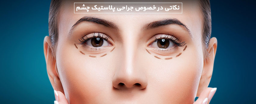 نکاتی در خصوص جراحی پلاستیک چشم