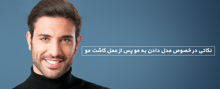 نکاتی در خصوص مدل دادن به مو پس از عمل کاشت مو