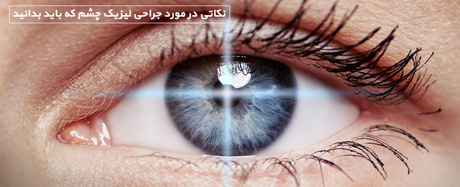 نکاتی در مورد جراحی لیزیک چشم که باید بدانید