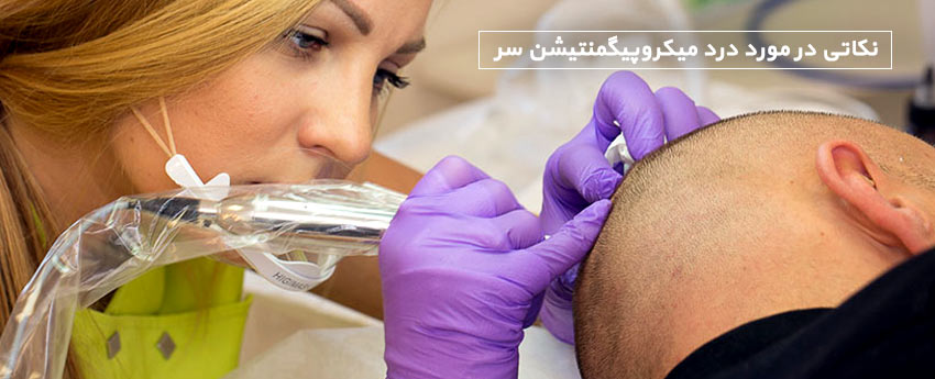 نکاتی در مورد درد میکروپیگمنتیشن سر