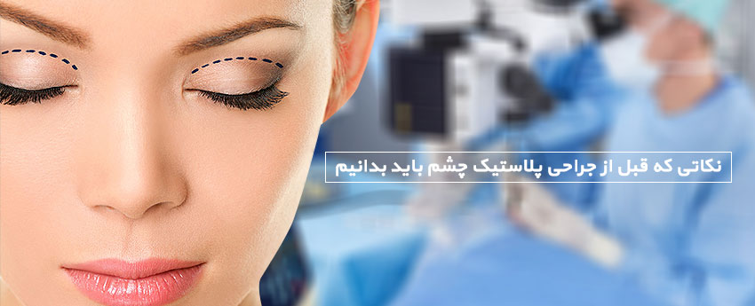 نکاتی که قبل از جراحی پلاستیک چشم باید بدانیم