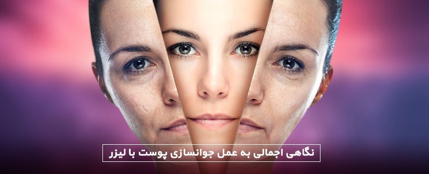نگاهی اجمالی به عمل جوانسازی پوست با لیزر