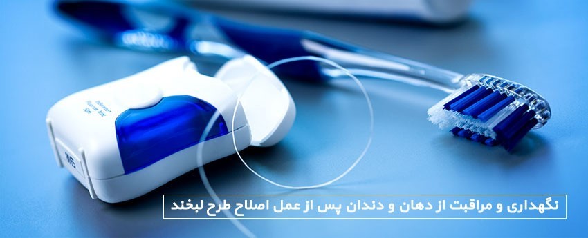 نگهداری و مراقبت از دهان و دندان پس از عمل اصلاح طرح لبخند