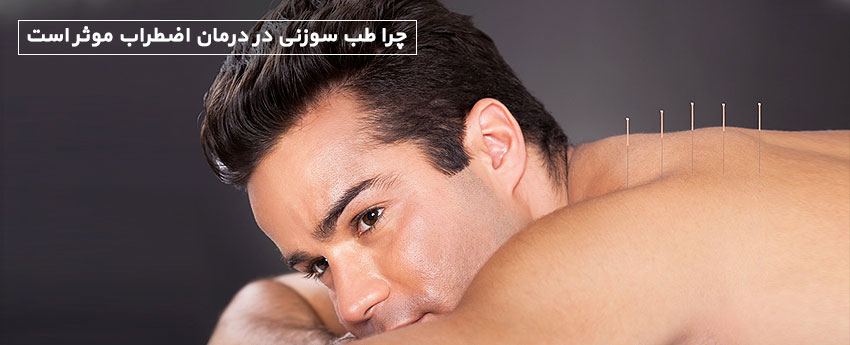 چرا طب سوزنی در درمان اضطراب موثر است