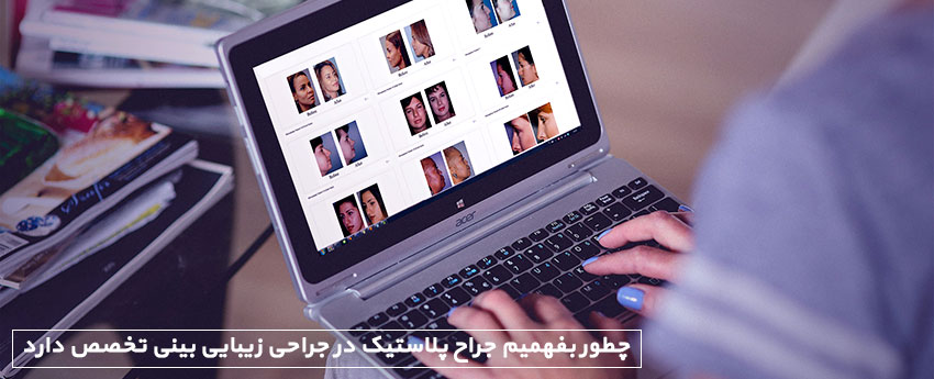 چطور بفهمیم جراح پلاستیک در جراحی زیبایی بینی تخصص دارد